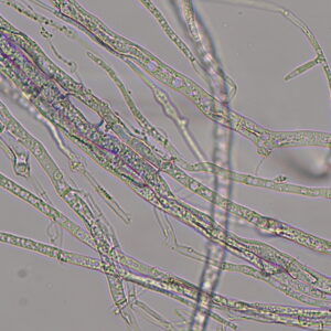 microscopic view of growing fungi