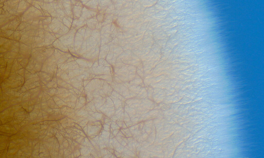 microscopic view of fungus